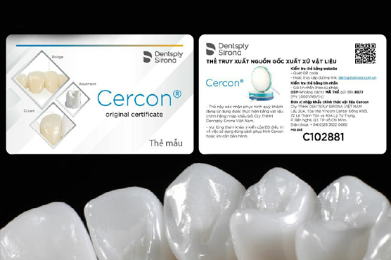 Thẻ bảo hành răng sứ Cercon HT