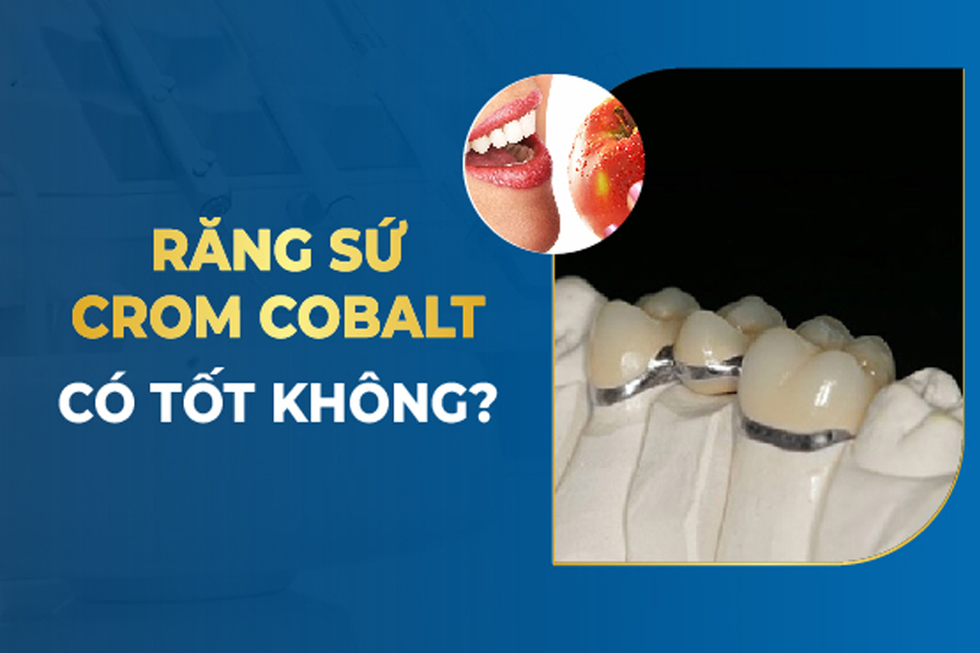 Răng sứ kim loại Crom Cobalt