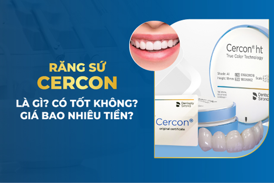 Răng sứ cercon của nước nào?